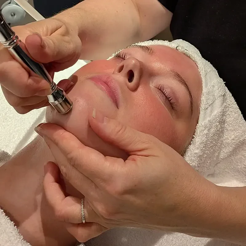 Customizable Skin Enhancement Treatments Microderm
