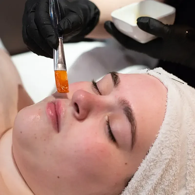 Custom Results Facial